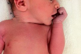 My birth story pt 1